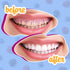 Lingito Dental Disclosing Tablets, Teeth Coloring Solution to Remove Plaque and Tartar Buildup (Grape Flavor - 120 Pack)