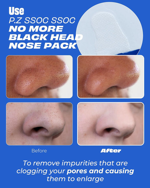One-day's you P.Z SSOC No More Blackhead Nose Strips | Hypoallergenic Korean Mask for Pore Care | 0.07 oz, 5 EA