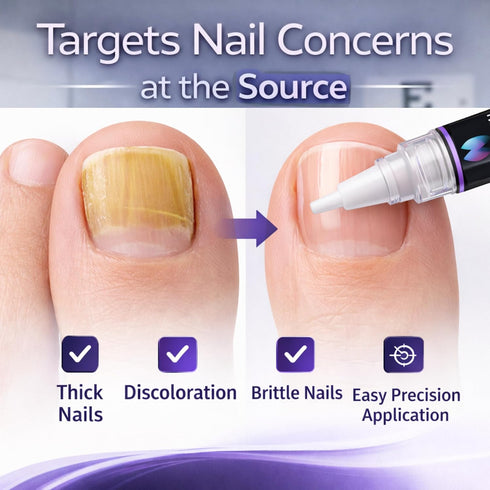 NOORISH FOOT CO. 2 Nail Fungus Treatment Pen for Toenails & Fingernails - Antifungal Nail Repair with Undecylenic Acid