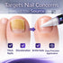 NOORISH FOOT CO. 2 Nail Fungus Treatment Pen for Toenails & Fingernails - Antifungal Nail Repair with Undecylenic Acid