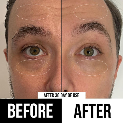 RUGGED & DAPPER Premium Men's Eye Cream | Age Defense for Dark Circles, Wrinkles & Puffy Eyes | Unscented with