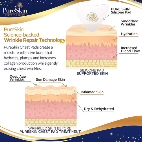 PureSkin Chest Wrinkle Pads - 3 PACK Decollete Anti Wrinkle Silicone Patches for Sleeping, Reusable