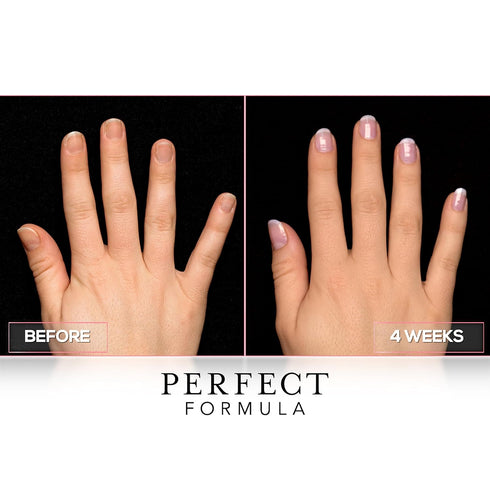 Perfect Formula Pink Gel Coat, Nail Strengthener and Hardener for Women, Keratin Treatment for Damaged Nails