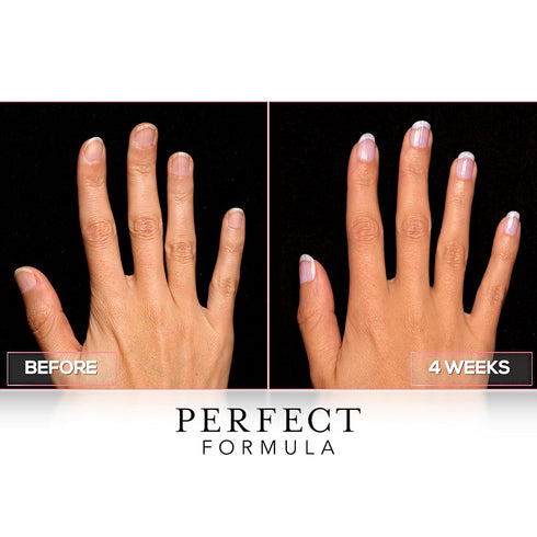 Perfect Formula Clear Gel Coat, Nail Strengthener, Keratin Treatment, 0.60 fl oz, Made in USA