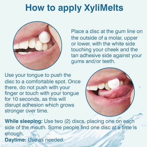 Oracoat XyliMelts Dry Mouth Relief Oral Adhering Discs, Non-Acidic, Time Release for up to 8 Hours, 230 Count