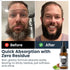 Honest Premium Beard Oil - Rugged Roots Beard Care for Dry Itchy Beard, All Natural Jojoba, Argan, Grape Seed