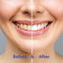 Pack Nano Hydroxyapatite Toothpaste Tablets for Ultimate Whitening - Refill