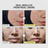 JUMISO Snail Mucin 95% + Peptide Essence, 4.73 fl oz - Hydrating Serum for Dry Skin, Daily Korean Skincare