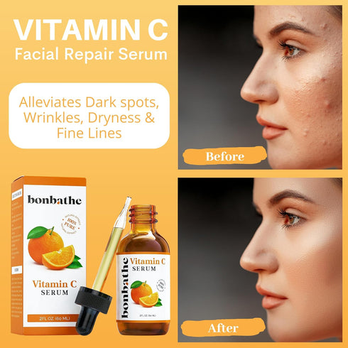 Vitamin C Serum for Face - 2oz Natural Anti-Aging Moisturizer, Brightening Dark Spot Remover with Hyaluronic Acid,