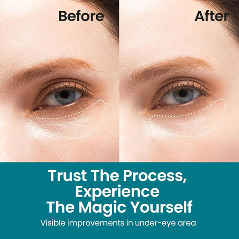Under Eye Patches for Dark Circles | Korean Under Eye Patches & Puffy Eye Patches | Moisturizing Dark Circles Under Eye Treatment Skincare Snail Mucin Eye Patches & Dark Eyes Circle Treatment