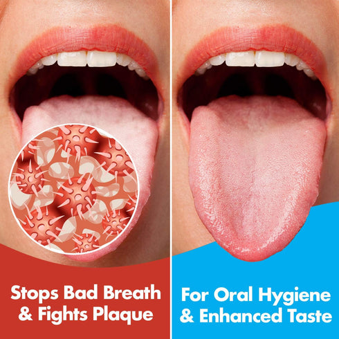 Pack of 2 Stainless Steel Tongue Scrapers, Essential Dental Hygiene Kit for Bad Breath & Bacteria Removal