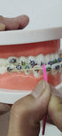 RZJZGZ Dental Elastic Rubber Bands Placers for Braces Disposable Plastic Multi-color (15PCS)