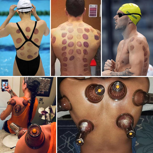 Cupping Therapy Set - 18 Massage Cups for Pain Relief, Physical Therapy Cupping Kit with Vacuum Pump