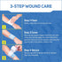 Care Science Hydrogel Sterile Burn Dressing Bandage Pads for Burn Relief, 4 ct | Instant Cooling Relief for Minor Burns