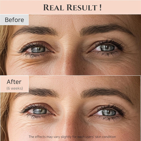 Beauty of Joseon Revive Eye Serum with Retinal Niacinamide, Correction for Puffy Eye Bags, Fine Lines, Dark Circles,