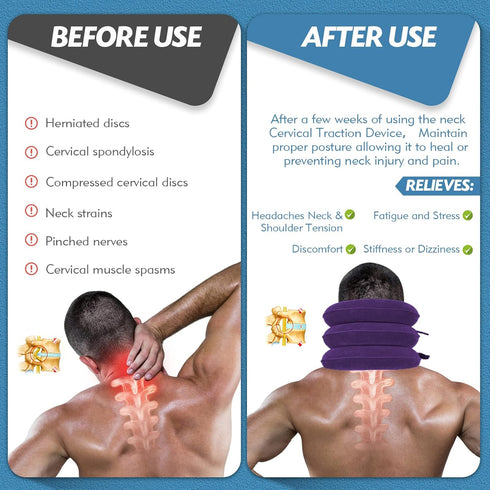 Neck Stretcher, Adjustable Cervical Traction Device for Neck Pain Relief, Inflatable Neck Brace for Home Use (Purple)