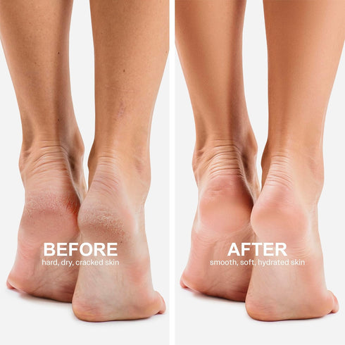 Original Derma Beauty Foot Mask Set, 12 Pairs Intense Hydration Avocado Oil Moisturizing Foot Masks