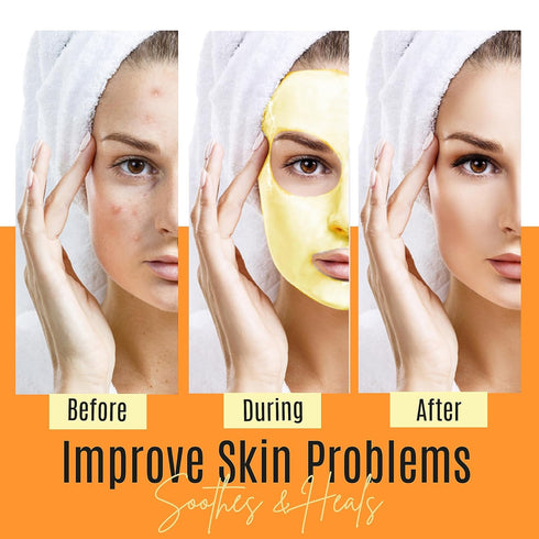 Turmeric Face Mask - Pure Organic Acne Treatment and Anti-Aging for Dull Skin Care, Set of 3