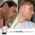 Hydrating Face Serum for Clearing Acne & Scars, Anti-Blemish & Scar Repair Serum for All Skin Types (1.01 oz)