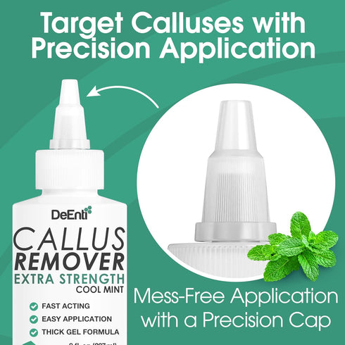 Pack, 4 DeEnti Callus Maintenance Bundle Includes Mint Scented Callus Remover, Metal Foot Rasp, Foot File, and Pairs