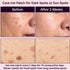 Micropoints for Acne Dark Spot Treatment, 127 Mircropoints Post-Blemish Dark Spots Removal Patch (9 count/pack)