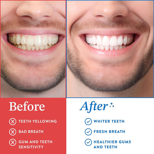 Coconut Oil Pulling for Teeth and Gums (Made in USA), Whitening Pulling Oil Coconut Mint Mouthwash for Fresh Breath, 8oz