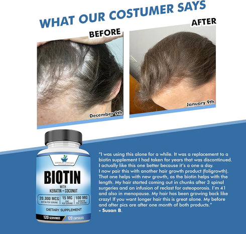 Biotin 20,000mcg with Keratin, Coconut Powder, and Zinc - Hair Growth Supplements for Healthy Hair, Skin & Nails