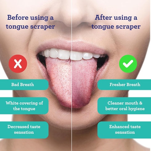 GuruNanda Tongue Scraper for Adults (2 Pack) with Travel Case, 420 Medical-grade 100% Stainless Steel Cleaner, Aids in