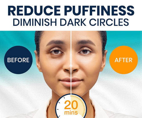 Under Eye Patches for Dark Circles and Puffy Eyes (30 Pairs), Marine Collagen Eye Gel Pads for Puffiness with Vitamin C, Hyaluronic Acid, and Pearl Extract, Eye Mask for Dark Circles and Puffiness