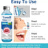 ZLSJJCLMZ Tonsil Stone Remover, Tonsil Stone Mouthwash to Help Soothe Tonsils, Oral Rinse Liquid for Eliminating Bad