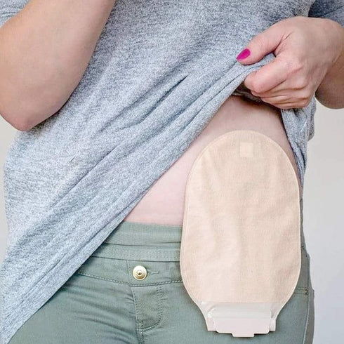 JJ CARE Ostomy Barrier Strips Pack of 20-5.62” Elastic Barrier Strips for Colostomy Bags, Waterproof & Moldable