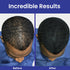 INFINITY Hair Fibers Dark Brown - 100% Undetectable Hair Building Fiber Powder, 15g