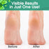 Pack, 4 DeEnti Callus Maintenance Bundle Includes Mint Scented Callus Remover, Metal Foot Rasp, Foot File, and Pairs