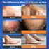 Seebeellar 2% 3.4 oz, 100g Antifungal Cream for Athletes Foot Jock Itch Ringworm Seborrheic Dermatitis Folliculitis