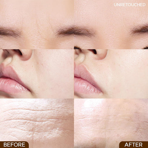 Wrinkle Repair Patches for Frown Lines, Smile Lines, Forehead Lines, Non-Invasive Smoothers for Face Wrinkles