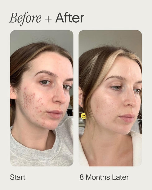 Topicals Faded Brightening Serum | Reduces Discoloration, Post-Blemish Marks & Scars | Kojic Acid & Niacinamide, 0.5 Fl