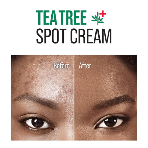 Tea Tree Spot Cream - Lightweight Face Spot Cream for Blemishes, Korean Skincare