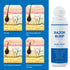 Razor Bump Stopper with Ingrown Hair Treatment for Men and Women, After Shave Solution for Ingrown Hairs, Roll on