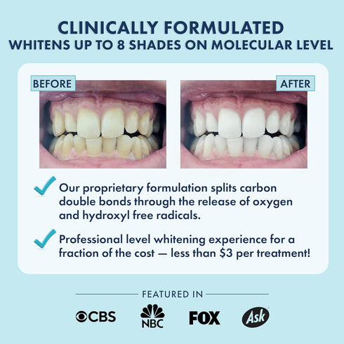Teeth Whitening Strips, Results in 14 Days, Enamel Safe for Sensitive Teeth, Coconut Oil & Hydrogen Peroxide