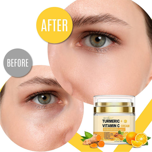 Turmeric Face Cream with 30% Vitamin C, Glow Boosting Moisturizer for All Skin Types, 1.7 FL OZ