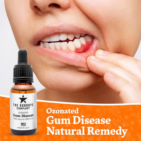 Ozonated Gum Disease Treatment, Natural Home Remedy for Oral Gum Disease, 100% Pure Neem and Clove Oils