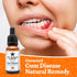 Ozonated Gum Disease Treatment, Natural Home Remedy for Oral Gum Disease, 100% Pure Neem and Clove Oils