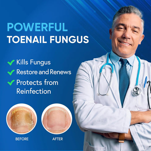 Toenail Fungus Treatment For Toenail & Finernails, 25% Undecylenic acid, Toe Nail Fungus Treatment Extra Strength, Tea Tree Oil for Tonail Fungus Treatment, Blue