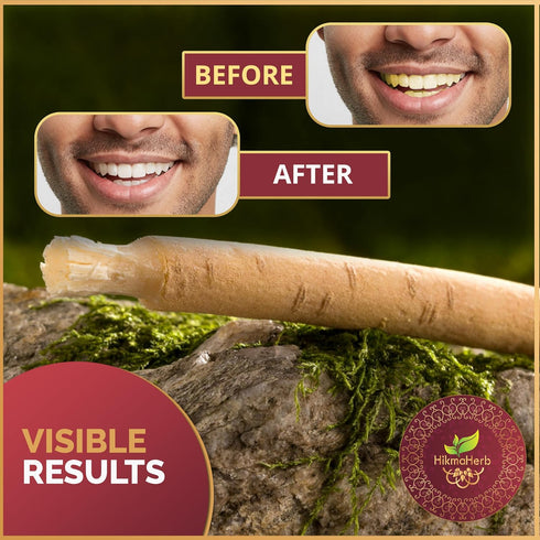 Pack of 3 Miswak Sticks with Holder, Natural Chewing Sticks for Teeth Whitening and Oral Health