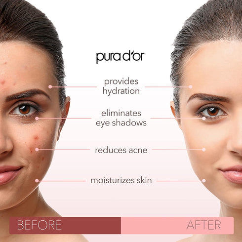PURA D'OR 16 Oz ORGANIC Sweet Almond Oil, 100% Pure & Natural Cold Pressed Carrier Oil for DIY Beauty