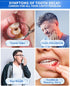 Upgraded Taste Hydroxyapatite Toothpaste for Cavity Repair, Fluoride Free Enamel Repair, 100g*1