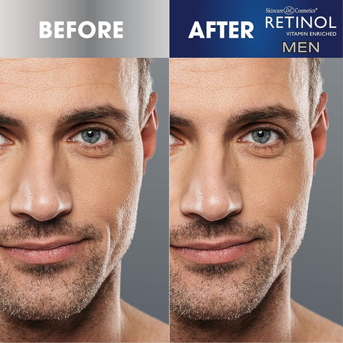 Retinol Men Facial Wipes - Anti-Aging Cleansing Towelettes, 60 Count (Pack of 1) - Quickly cleanse face without residue