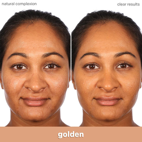 Almay Clear Complexion Acne Foundation, Lightweight Medium Coverage with Salicylic Acid, Hypoallergenic, 750 Golden, 1
