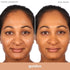 Almay Clear Complexion Acne Foundation Makeup with Salicylic Acid, Lightweight Medium Coverage, 705 Toast