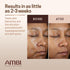 Ambi Even & Clear Fade Cream, Hydroquinone-free, Hyperpigmentation Treatment, Dark Spot Corrector, 1 Fl Oz